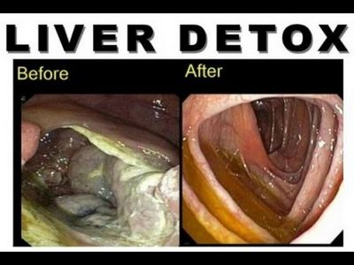 Benefits of a Colon Cleanse and Liver Cleanse colon cleanse or liver